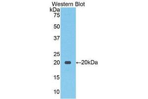 Western Blotting (WB) image for anti-Solute Carrier Family 12 (Sodium/Chloride Transporters), Member 3 (SLC12A3) (AA 867-1024) antibody (ABIN1859969) (SLC12A3 Antikörper  (AA 867-1024))