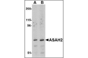 Western blot analysis of ASAH2 in 293 cell lysate with ASAH2 antibody at (A) 1 and (B) 2 µg/ml. (ASAH2 Antikörper  (C-Term))