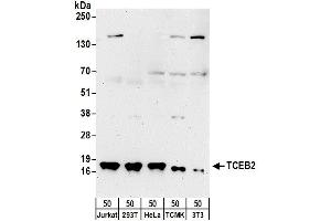Western Blotting (WB) image for anti-Transcription Elongation Factor B (SIII), Polypeptide 2 (18kDa, Elongin B) (TCEB2) (AA 68-118) antibody (ABIN7453458)