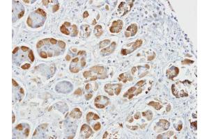 IHC-P Image Immunohistochemical analysis of paraffin-embedded human stomach, using GSTA2, antibody at 1:100 dilution.