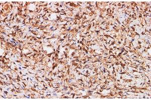 Immunohistochemistry of paraffin-embedded Human ovary using S100A11 Polyclonal Antibody at dilution of 1:200 (S100A11 Antikörper)