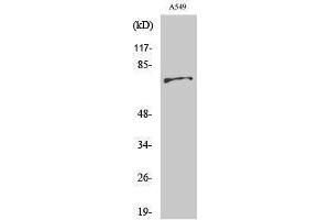 Western Blotting (WB) image for anti-BMX Non-Receptor Tyrosine Kinase (BMX) (Ser182) antibody (ABIN3183533) (BMX Antikörper  (Ser182))
