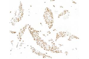 Immunocytochemistry (ICC) image for anti-SWI/SNF Related, Matrix Associated, Actin Dependent Regulator of Chromatin, Subfamily E, Member 1 (SMARCE1) (C-Term) antibody (ABIN7795731)