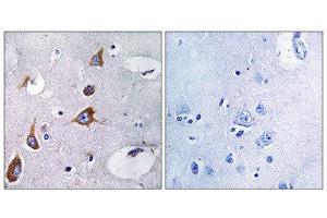 Immunohistochemistry (IHC) image for anti-Chondroitin Sulfate Synthase 1 (CHSY1) (Internal Region) antibody (ABIN1851106) (CHSY1 Antikörper  (Internal Region))