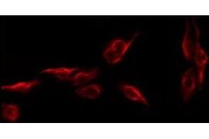 ABIN6279501 staining CoLo by IF/ICC. (NKX6-1 Antikörper  (Internal Region))