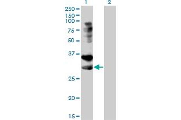 HVEM Antikörper  (AA 38-283)