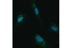 IF analysis of UBC12/UBE2M using anti-UBC12/UBE2M antibody (ABIN7600885). (UBE2M Antikörper  (AA 25-154))