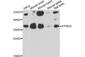 Western blot analysis of extracts of various cell lines, using EPM2A antibody (ABIN5974214) at 1/1000 dilution. (EPM2A Antikörper)