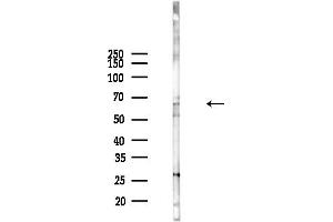 anti-Neuroepithelial Cell Transforming 1 (NET1) (C-Term) antibody