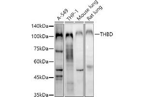Western blot analysis of extracts of various cell lines, using THBD antibody (ABIN1683026, ABIN3018621, ABIN3018622 and ABIN6220518) at 1:1000 dilution. (Thrombomodulin Antikörper  (AA 200-500))