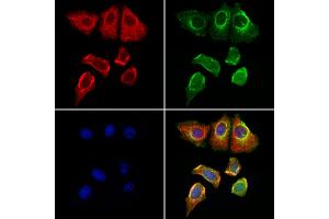 ABIN6262069 and ABIN6276964 staining Hela cells by IF/ICC. (GPX4 Antikörper  (C-Term))