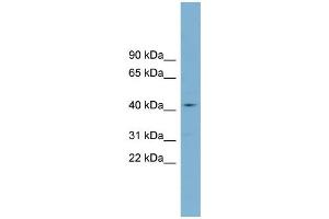 WB Suggested Anti-ZDHHC18  Antibody Titration: 0. (ZDHHC18 Antikörper  (Middle Region))