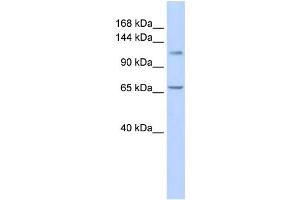 Western Blotting (WB) image for anti-Zinc Finger and BTB Domain-Containing Protein 10 (ZBTB10) antibody (ABIN2458201) (ZBTB10 Antikörper)
