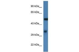 WB Suggested Anti-Fscn1 Antibody   Titration: 1.