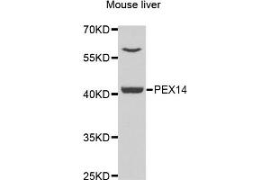 Western blot analysis of extracts of mouse liver, using PEX3 antibody.