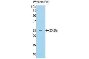 Western Blotting (WB) image for anti-RAD50 Homolog (S. Cerevisiae) (RAD50) (AA 400-595) antibody (ABIN1176803) (RAD50 Antikörper  (AA 400-595))