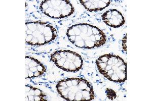 Immunohistochemistry of paraffin-embedded mouse pancreas using SOX9 Rabbit pAb (ABIN1682861, ABIN5664083, ABIN5664085 and ABIN6219552) at dilution of 1:100 (40x lens). (SOX9 Antikörper  (AA 100-200))