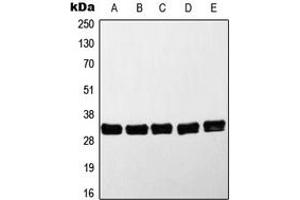 Western blot analysis of MYD88 expression in HeLa (A), Jurkat (B), K562 (C), Raji (D), Molt4 (E) whole cell lysates. (MYD88 Antikörper  (Center))