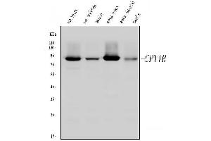 Western blot analysis of CPT1B using anti-CPT1B antibody (ABIN3042757). (CPT1B Antikörper  (N-Term))