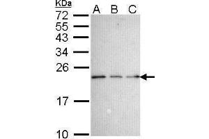 Western Blotting (WB) image for anti-Nerve Growth Factor Receptor (TNFRSF16) Associated Protein 1 (NGFRAP1) (Center) antibody (ABIN2855376)