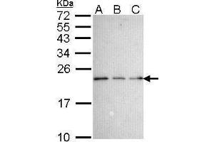 WB Image Sample (30 ug of whole cell lysate) A: 293T B: A431 , C: H1299 15% SDS PAGE antibody diluted at 1:1000 (Nerve Growth Factor Receptor (TNFRSF16) Associated Protein 1 (NGFRAP1) (Center) Antikörper)
