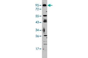 Western blot analysis of K-562 cell lysate (35 ug/lane) with Tlr6 polyclonal antibody . (TLR6 Antikörper  (C-Term))