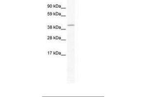 Image no. 1 for anti-GATA Binding Protein 5 (GATA5) (AA 321-370) antibody (ABIN202438) (GATA5 Antikörper  (AA 321-370))