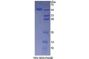 SDS-PAGE (SDS) image for Sperm Associated Antigen 1 (SPAG1) (AA 1-365) protein (His tag) (ABIN6238698)