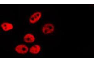 ABIN6278620 staining Hela by IF/ICC. (PER3 Antikörper  (Internal Region))