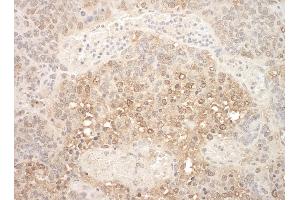 Immunohistochemistry (IHC) image for anti-Anaphase Promoting Complex Subunit 7 (ANAPC7) (AA 515-565) antibody (ABIN7448413)