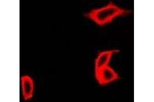 Immunofluorescent analysis of CCBL1 staining in Hela cells. (CCBL1 Antikörper)