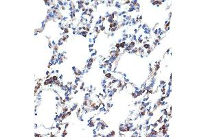 Immunohistochemistry of paraffin-embedded rat lung using ERp29 Rabbit mAb (ABIN7266943) at dilution of 1:100 (40x lens). (ERP29 Antikörper)