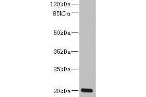 Western blot All lanes: ZMAT5 antibody at 5 μg/mL + Colo320 whole cell lysate Secondary Goat polyclonal to rabbit IgG at 1/10000 dilution Predicted band size: 20 kDa Observed band size: 20 kDa (ZMAT5 Antikörper  (AA 1-170))