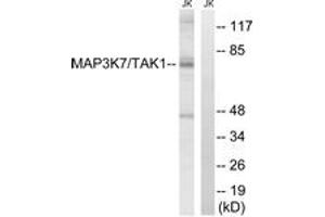 Western blot analysis of extracts from Jurkat cells, treated with heat shock, using MAP3K7 (Ab-187) Antibody. (MAP3K7 Antikörper  (AA 161-210))