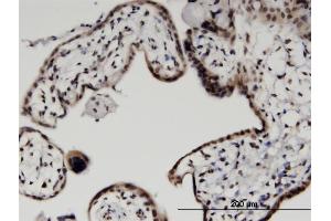 Immunostaining (ISt) image for anti-Histone H2B Type 2-E (HIST2H2BE) (AA 36-126) antibody (ABIN521858)