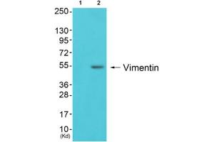 Western blot analysis of extracts from 293 cells (Lane 2), using Vimentin Antibody. (Vimentin Antikörper  (C-Term))