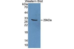 Western blot analysis of the recombinant protein. (PTPRN2 Antikörper  (AA 782-1001))