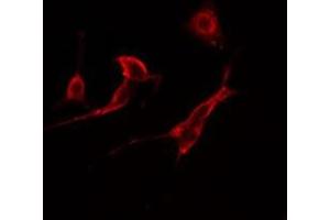 ABIN6277770 staining  HuvEc cells by IF/ICC. (CSNK2B Antikörper  (Internal Region))
