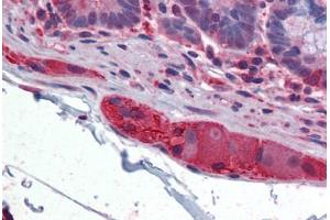 Human Small Intestine, submucosal plexus: Formalin-Fixed, Paraffin-Embedded (FFPE) (TUBB2A Antikörper  (AA 1-446))