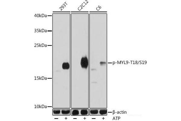 MYL9 Antikörper  (pSer19, pThr18)