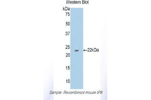 Western blot analysis of the recombinant protein. (PLAT Antikörper  (AA 359-532))