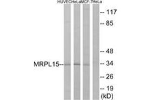 Western blot analysis of extracts from HeLa/HuvEc/MCF-7 cells, using MRPL15 Antibody. (MRPL15 Antikörper  (AA 191-240))