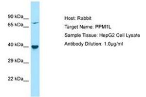 Image no. 1 for anti-Protein Phosphatase, Mg2+/Mn2+ Dependent, 1L (PPM1L) (AA 141-190) antibody (ABIN6750224) (PPM1L Antikörper  (AA 141-190))