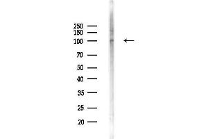 anti-Ubiquitin Specific Peptidase 29 (USP29) antibody