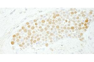 Immunohistochemistry (IHC) image for anti-CDC5 Cell Division Cycle 5-Like (S. Pombe) (CDC5L) (AA 752-802) antibody (ABIN7448468) (CDC5L Antikörper  (AA 752-802))