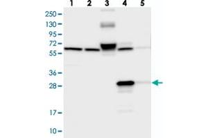 Western blot analysis of Lane 1: RT-4, Lane 2: U-251 MG, Lane 3: Human Plasma, Lane 4: Liver, Lane 5: Tonsil with ECHDC3 polyclonal antibody  at 1:250-1:500 dilution.