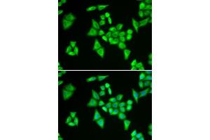 Immunofluorescence analysis of HeLa cells using ADSL antibody. (Adenylosuccinate Lyase Antikörper  (AA 1-310))