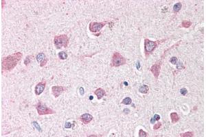 Human Brain, Cortex (formalin-fixed, paraffin-embedded) stained with ING3 antibody ABIN291938 at 2. (ING3 Antikörper  (AA 294-304))
