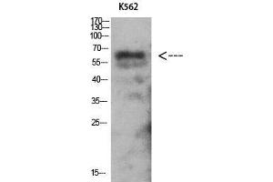 Western Blot (WB) analysis of K562 using Antibody diluted at 1:1000. (PRKAG2 Antikörper  (N-Term))