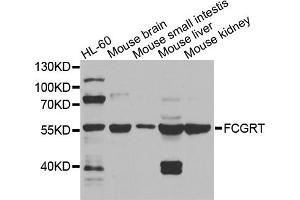 Western blot analysis of extracts of various cell lines, using FCGRT antibody. (FcRn Antikörper)